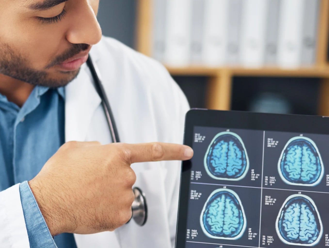 Care for neurological conditions at different stages of recovery.